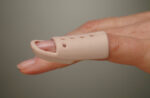 Mallet Finger Splint (MFS)