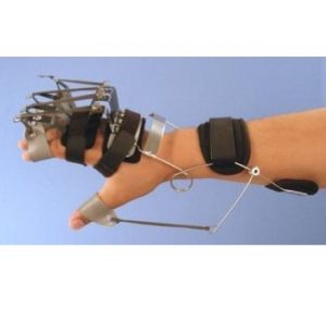 Serial Dynamic Hand Splint Dynamic Hand Splint | Abu Lail Medical & Sport Center